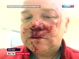 Топ-менеджер "Газпрома" после драки в "Шереметьево" подает в суд на адвоката из дела "Славянки" Топ-менеджер "Газпрома" после драки в "Шереметьево" подает в суд на адвоката из дела "Славянки"