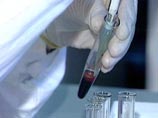 В Минздраве утверждают, что чудо с излечением детей от ВИЧ в РФ произошло раньше, чем в США В Минздраве утверждают, что чудо с излечением детей от ВИЧ в РФ произошло раньше, чем в США