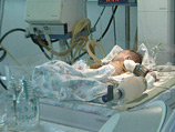 Младенцу был поставлен диагноз "токсическая интоксикация организма с отеком головного мозга"