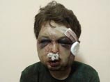 Femen сообщает о похищении трех активистов, журналиста и белой собачки Femen сообщает о похищении трех активистов, журналиста и белой собачки