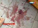 Директор базы отдыха в Тарусе, где жестоко избили туристов, сдался полиции Директор базы отдыха в Тарусе, где жестоко избили туристов, сдался полиции