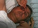 В Нижнем Новгороде избит телеоператор, снимавший ролики вместе с правозащитниками про пытки В Нижнем Новгороде избит телеоператор, снимавший ролики вместе с правозащитниками про пытки