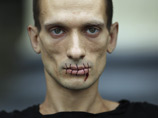 Павленский известен своими громкими акциями протеста, связанными с увечьями