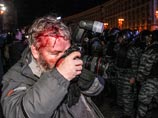 Киевская милиция завела более 20 уголовных дел по факту избиений журналистов во время акций протеста в украинской столице Киевская милиция завела более 20 уголовных дел по факту избиений журналистов во время акций протеста в украинской столице
