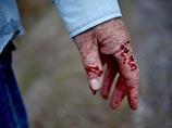 Пираньи покусали более 70 человек на пляже в Аргентине Пираньи покусали более 70 человек на пляже в Аргентине