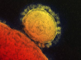 Индонезия сообщила о первой возможной жертве "верблюжьего гриппа"