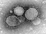 В США зафиксировали второй случай заболевания синдром респираторного коронавируса Ближнего Востока (MERS-CoV)