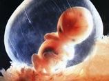 Видные британские ученые обвиняют правительство Соединенного Королевства в том, что оно пытается протащить законопроект, разрешающий создание "генно-модифицированных младенцев" Видные британские ученые обвиняют правительство Соединенного Королевства в том, что оно пытается протащить законопроект, разрешающий создание "генно-модифицированных младенцев"