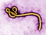 Лихорадка Эбола - острая вирусная высококонтагиозная болезнь, вызываемая вирусом Эбола