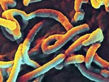 Профессору Дзиро Ясуде и его команде из университета японского города Нагасаки удалось изобрести новый способ определения лихорадки Эбола
