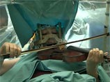 Литовская скрипачка во время операции на мозге успешно сыграла произведения Моцарта и Чайковского (ВИДЕО)