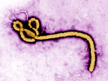 В США в штате Гавайи в больницу поступил пациент с подозрением на лихорадку Эбола
