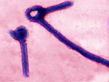 Ситуация с лихорадкой Эбола по-прежнему остается тревожной. В настоящее время, согласно официальным данным Всемирной организации здравоохранения (ВОЗ), число инфицированных смертельным вирусом достигло 13703 человек