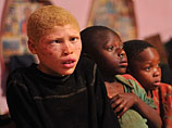 В Танзании запретили колдовство ради спасения альбиносов