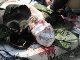 Раненый журналист "Звезды" остается в тяжелом состоянии, в ОБСЕ говорят о тысяче зафиксированных взрывов Раненый журналист "Звезды" остается в тяжелом состоянии, в ОБСЕ говорят о тысяче зафиксированных взрывов