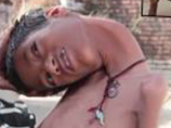 "Это не жизнь": полсотни индийских врачей не смогли понять, чем болен 12-летний мальчик с "резиновой" шеей