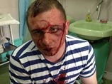 В Киевской области кавказцы дважды выстрелили в лицо депутату от партии Кличко В Киевской области кавказцы дважды выстрелили в лицо депутату от партии Кличко