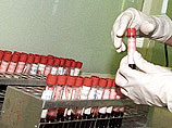 Первое массовое обследование на гепатит C в Подмосковье заставило специалистов говорить об эпидемии