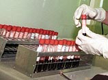 Депутат от Чечни предложил Госдуме обязать россиян проходить тест на ВИЧ перед свадьбой Депутат от Чечни предложил Госдуме обязать россиян проходить тест на ВИЧ перед свадьбой