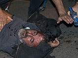 В Черногории восемь человек получили ранения в ходе акции оппозиции