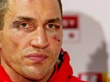 Владимир Кличко потребовал реванша с Тайсоном Фьюри в 2016 году Владимир Кличко потребовал реванша с Тайсоном Фьюри в 2016 году