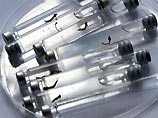 Роспотребнадзор рекомендовал отказаться от поцелуев из-за угрозы распространения вируса Зика Роспотребнадзор рекомендовал отказаться от поцелуев из-за угрозы распространения вируса Зика