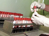 СПЧ предложил принудительно тестировать детей на наркотики