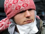 Во французском Кале иранские беженцы зашили себе рты в знак протеста против сноса лагеря 
