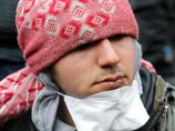 Во французском Кале иранские беженцы зашили себе рты в знак протеста против сноса лагеря Во французском Кале иранские беженцы зашили себе рты в знак протеста против сноса лагеря
