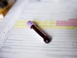 WADA признало неэффективность лабораторных анализов на допинг WADA признало неэффективность лабораторных анализов на допинг