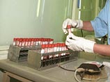 Эпидемия ВИЧ в 20 регионах России достигла высшей стадии, заявили эксперты