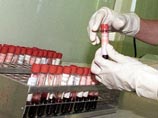 На улице в Москве обнаружили пробирки с кровью, которые могут быть опасны для людей На улице в Москве обнаружили пробирки с кровью, которые могут быть опасны для людей