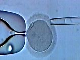 Врачам пришлось искусственно в пробирках зародить 15 эмбрионов. Здоровым оказался только один
