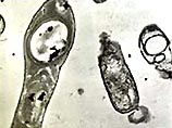 Американские ученые оживили бактерию, возраст которой 250 миллионов лет 