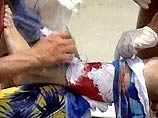 В США 6 человек пострадали в результате нападений акул на пляжах Флориды