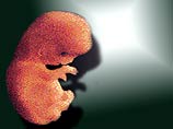 Женщина должна родить девочку, но спустя три месяца, она вновь вернется в эту больницу, чтобы родить тройню Женщина должна родить девочку, но спустя три месяца, она вновь вернется в эту больницу, чтобы родить тройню