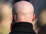 На сеть наркодилеров итальянскую полицию навела лысина одного из них На сеть наркодилеров итальянскую полицию навела лысина одного из них