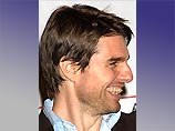 39-летний кино-идол проходит курс лечения по удалению щербин 39-летний кино-идол проходит курс лечения по удалению щербин