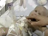 Три младенца, которым было всего по 3 месяца, уже скончались от недуга