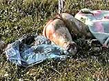 В сумке лежало туловище мужчины с бедрами до коленных суставов В сумке лежало туловище мужчины с бедрами до коленных суставов