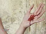 Одна из "героинь" Мальоцци демонстрирует кровоточащие раны на ладонях, другая - предстает в позе кающейся грешницы