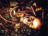 18-летнему Майклу Херцу и 17-летнему Майклу Сосси из Нью-Йорка инкриминировали надругательство над скелетом Элмера Грандена. Подростки также взяли еще два черепа из склепа на кладбище Лонг-Айленда.
