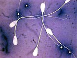 Как удалось выяснить ученым, сперматозоиды приводятся в движение протеином под названием динеин, который был обнаружен также в легких, нервной системе и в других частях организма человека