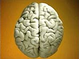 Сканирование головного мозга станет одним из методов проведения тестов IQ