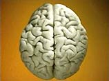 Сканирование головного мозга станет одним из методов проведения тестов IQ Сканирование головного мозга станет одним из методов проведения тестов IQ