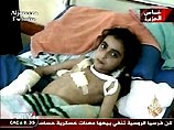 Операторы Al-Jazeera сняли обстановку внутри одного из госпиталей города, куда постоянно привозят раненых детей, женщин, стариков