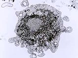 Вирус атипичной пневмонии представляет собой синтез двух известных вирусов (кори и инфекционного паротита, или свинки), естественное соединение которых в природе невозможно