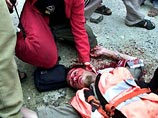 Англичанин попытался вывести из-под огня палестинских детей, оказавшихся в зоне боевых действий. Молодой человек, прикрывший собой детей, был ранен в голову
