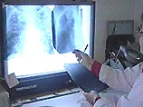 В тюремных больницах не хватает 12 тысяч мест для лечения больных туберкулезом В тюремных больницах не хватает 12 тысяч мест для лечения больных туберкулезом
