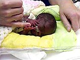 Британка родила девочку величиной с ладонь Британка родила девочку величиной с ладонь